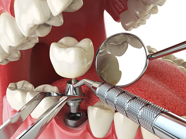 Best Emergency Dental Extractions in South Pittsburg, TN